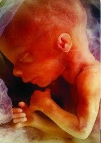 Poème:Maman, Ne me tues pas...!